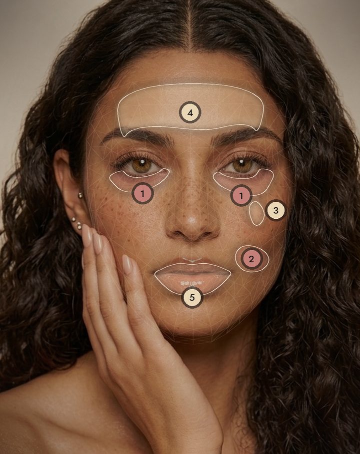 A face map with numbered treatment areas